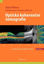 opticka-koherencni-tomografie.png